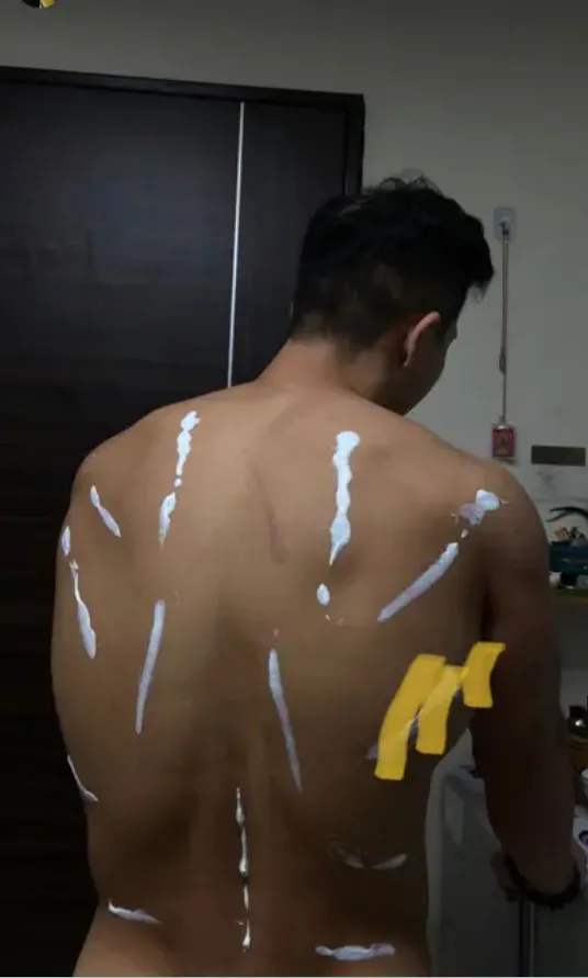 小三還分享浩克被揍後的療傷照。翻攝《Dcard》論壇