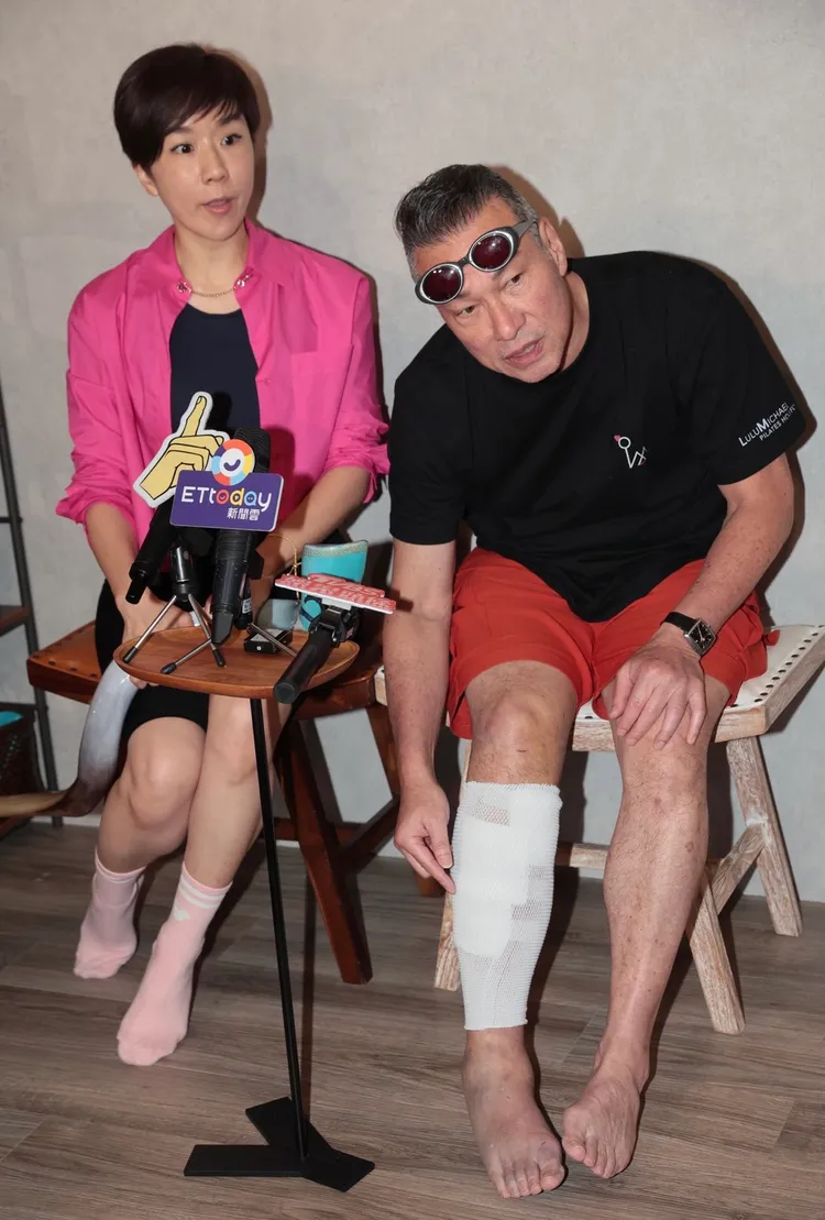 黃仲崑（右）右腿蜂窩性組織炎，是Lulu硬逼才去醫院治療。彭欣偉攝