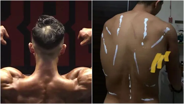朱男後腦、背部有明顯傷勢。翻攝自當事人IG
