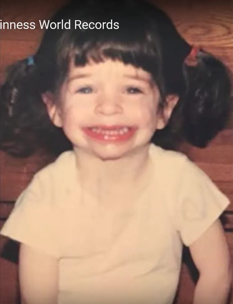 小時候嘴巴就看得出來很寬。金氏世界紀錄