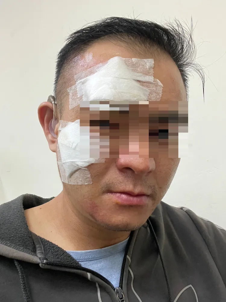 陳男遭警方壓制導致臉部多處擦挫傷。陳男提供