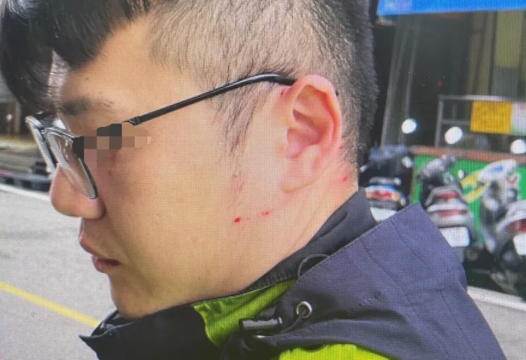 被打傷的警員。中壢警分局提供