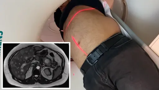 42歲男腹痛就醫 驗孕竟呈「陽性」原因是這樣
