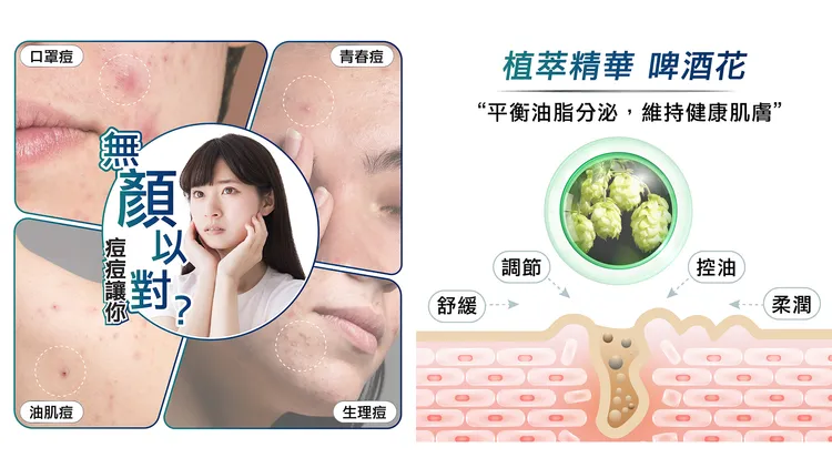 ▲身體和臉部新長出的難消痘痘，一冒出來既不美觀也很不舒服，使用後讓痘痘不再困擾你。