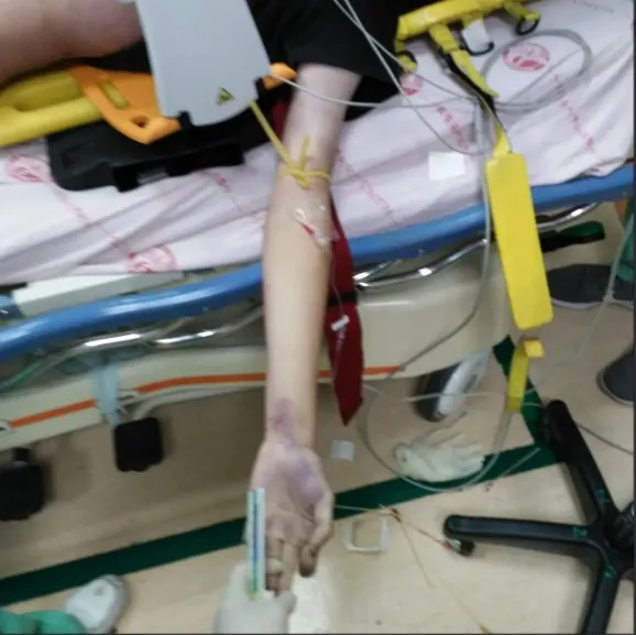 高中生被送到急診室時，約已死亡半小時。高大成提供