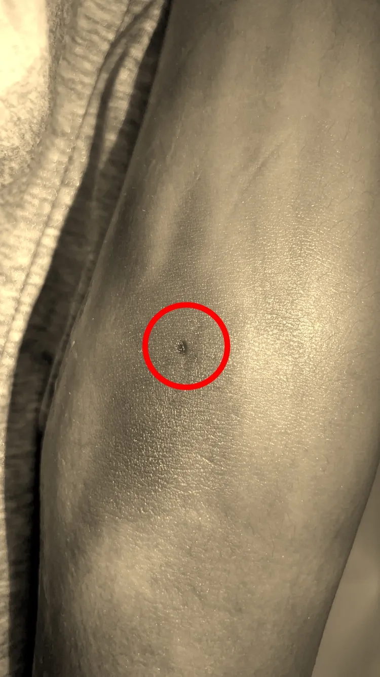 高大成公布高中生遺體右手處有可疑針孔。高大成提供