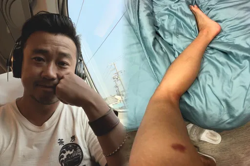 受害者+1 金馬導演騙進房強行進入 女演員傷勢曝光