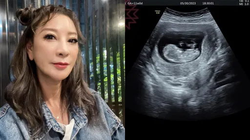 58歲楊繡惠貼寶寶超音波照　嗨喊「恭喜我吧！」網驚：小白雲？