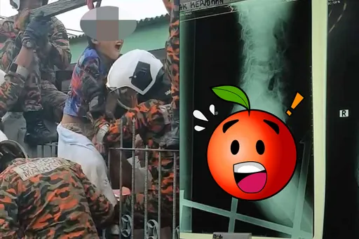 好痛!他爬牆失足慘遭「千年殺」 20公分鐵刺直插屁股