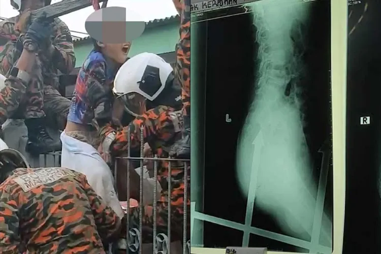 男童被籬笆尖刺刺入臀部痛到哀號。取自中國報