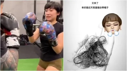 網紅「麵包包」造假罹癌!掉髮鼻血X光都盜圖 前夫揪疑點逼她認栽了