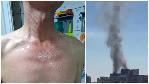 竹北氣爆住戶裸逃! 目擊者:廚房砰一聲「炸到我爸多處灼傷」