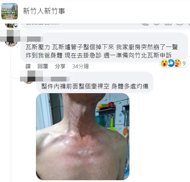 住戶貼出長輩遭氣爆波及受傷畫面。取自臉書「新竹人新竹事」