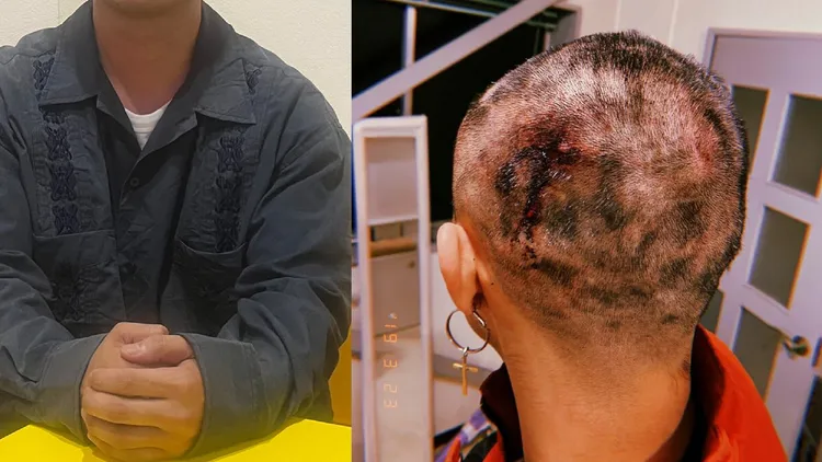 與Candle JUNE共事超過10年的前員工爆料，4年前因女性問題被Candle JUNE毆打、剃光頭。翻攝《週刊女性》