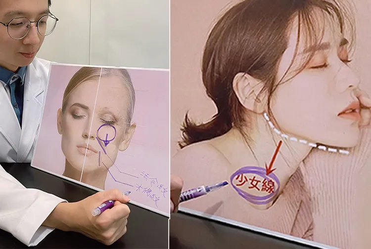 愛爾麗醫療美容診所黃浩然醫師表示，影響視覺年齡的關鍵就在於臉部線條。愛爾麗診所提供