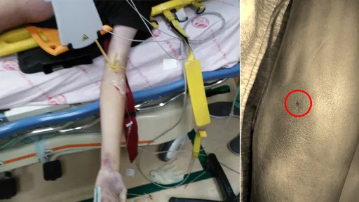 5億高中生無毒物反應!關鍵右手針孔 律師:醫院沒拍到