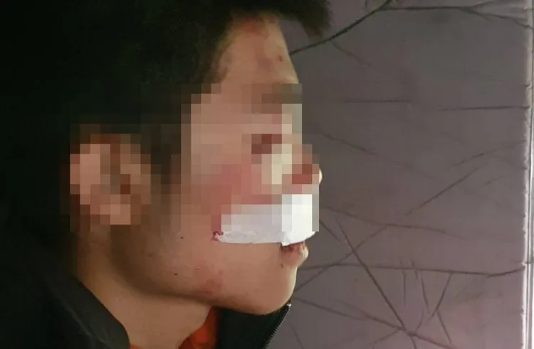 中央大學登山隊男隊員不慎摔落山谷，幸運獲救。空勤總隊提供