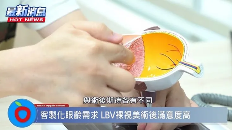 「LBV裸視美老花熟齡雷射」能同時矯正老花、近視、遠視、散光等問題。