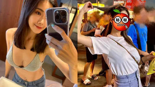 「廟會女神」患罕病!月吞330顆藥長鬍子 崩潰公開0修圖照:別再霸凌