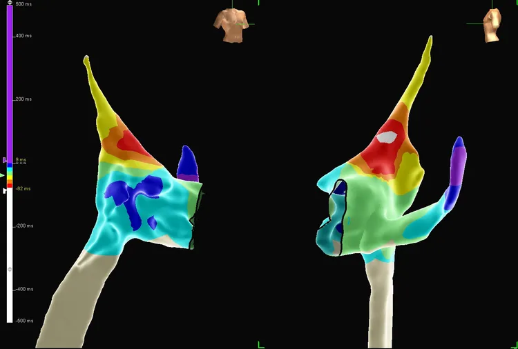 醫師陳威達透過3D立體定位系統，完成北醫體系首例孕婦無輻射電燒手術。北醫提供