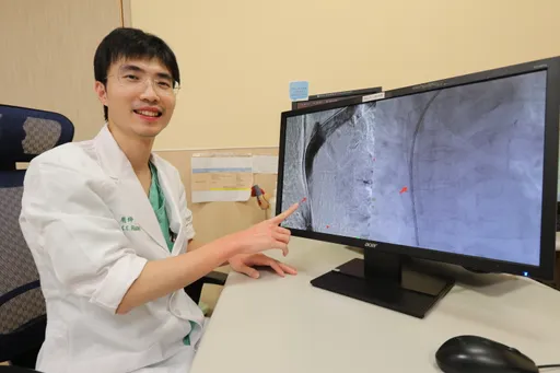 洗腎婦「水腫像豬頭」 上腔靜脈症候群作祟!心臟支架手術助消腫