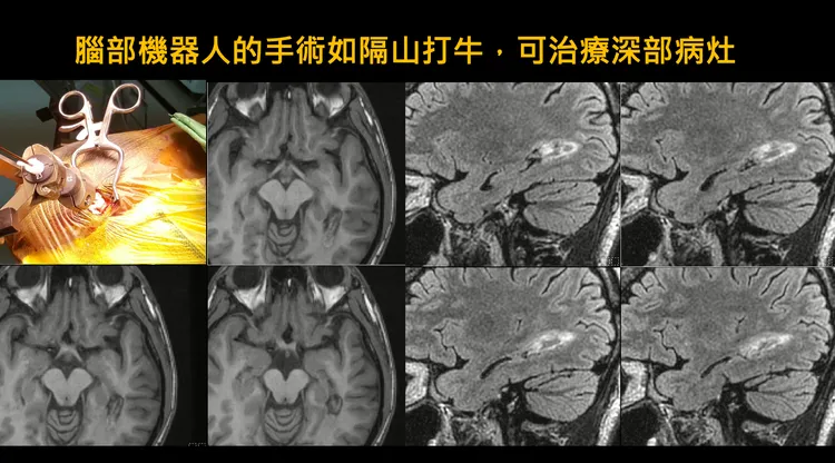 機器人手臂除省時外，最大優勢則是安全性高。北榮提供
