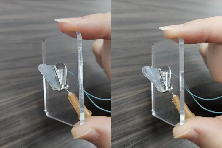 新式可調式咽喉植入物，生理食鹽水注入前(左)、注入後上方膨出(右)。馬偕醫院提供