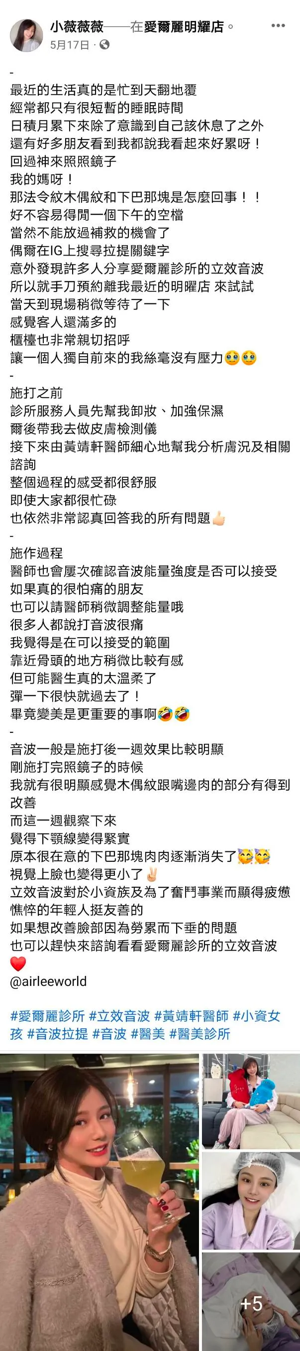 長相清新女模小薇在網路上分享自己的「網美養成記」。翻攝《小薇薇薇》的粉絲頁