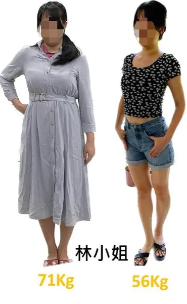 林小姐4個月瘦15公斤。北市聯醫林森中醫昆明院區針灸科提供