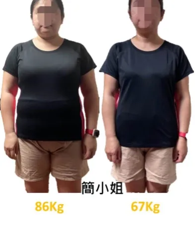 簡小姐半年減19公斤。北市聯醫林森中醫昆明院區針灸科提供