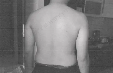 警方第一時間請夏男脫掉上衣檢查，未發現身體、雙手有傷口。檢方提供