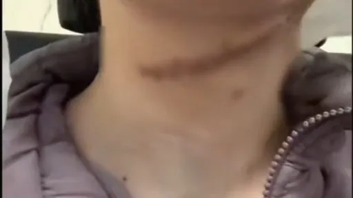 婚姻的代價?人妻遭老公割喉16公分 法院:「輕傷」、關1年半賠4.2萬