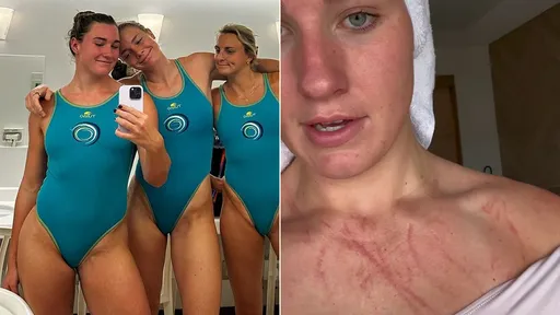 水球女運動員「胸口慘遍尖爪肆虐」　po影片譏諷：我好喜歡跟中國比賽