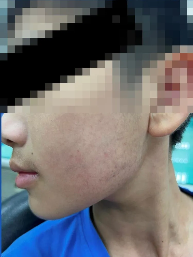 生母指控，孩子臉頰傷勢根本非醫師爸宣稱的輕微紅腫。翻攝自臉書「嘎老師 Miss Ga」