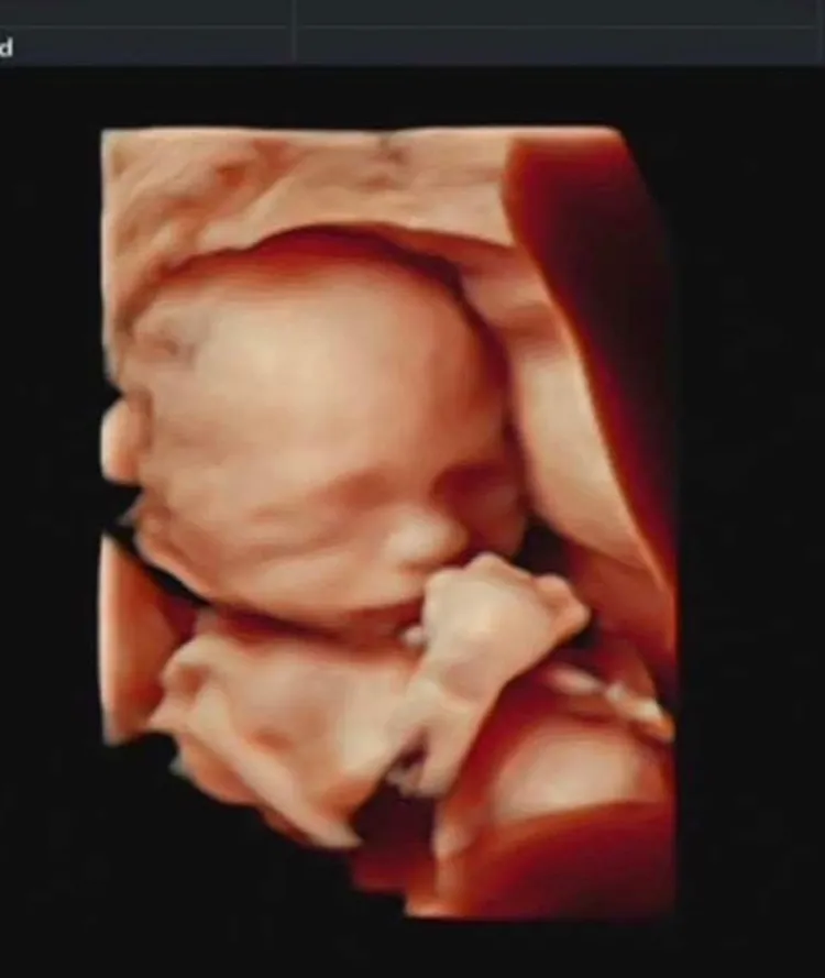 小壞壞正面照。翻攝古斌IG