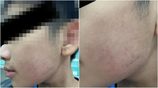 網紅醫師呼兒100巴掌又踹胸 生母通報家暴!孩子現況曝光