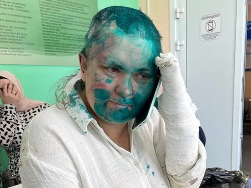 剃光髮、臉潑漆、打斷指 俄女記者車臣遇襲