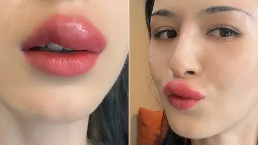 女演員「慘遭強吻」咬出香腸嘴 兇手是牠!嚴肅影片讓百萬人笑噴