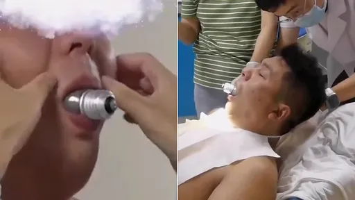 不相信「燈泡塞嘴裡拿不出來」 他鐵齒實測GG了