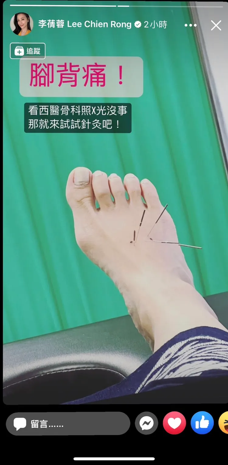 李蒨蓉跟老公逛台北101前30分鐘，便在社群粉專PO文，正在看中醫針灸醫腳的動態。翻攝李蒨蓉臉書