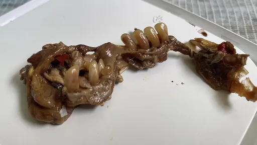 吃沙拉竟吃到「整排牙齒」　她狂嘔哀號：吐多少次才能把胃清空