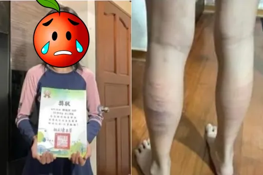 「第5名藤條狂抽40下」爸爸道歉了! 解釋剃女兒光頭原因讓網友更怒