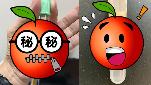 病人的血油油的!醫曝血油分離照 網驚:跟冰箱那罐豬油是一樣的