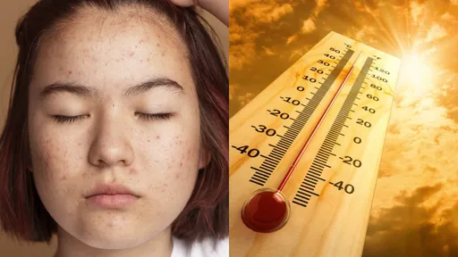 夏日炎炎愛「呷涼」生理痘大爆發靠「它」