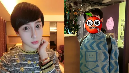 「蛇精男」現在變這樣!近照曝光認不出 網驚:挺帥啊