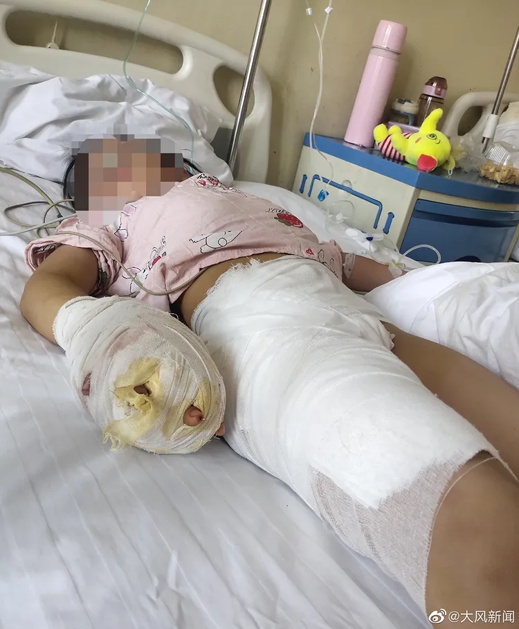 中國媒體報導受虐的７歲女童終身殘疾。