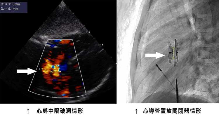 術前術後對照。院方提供
