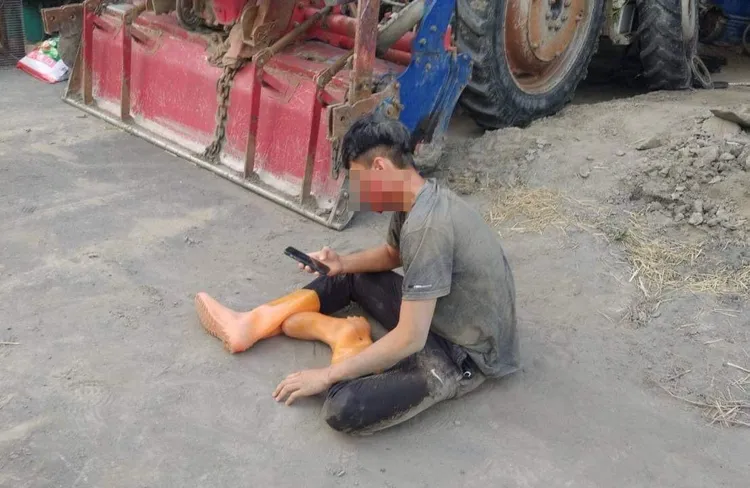 少年臉部被割傷，送醫縫了10多針。民眾提供