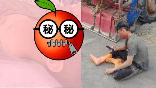 彰化少年冤遭警抓!17针的伤口曝光 左脸如被「切开」快裂到耳朵