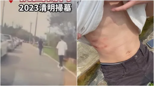 行人遭撞傷還被罰500元　Cheap開嗆：請警員示範怎麼走